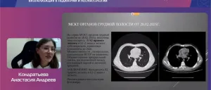 Интересный клинический случай – на всероссийской конференции!